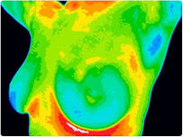 Thermography - Early Breast Detection