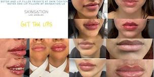 Lip Filler and Botox Friday's at our Medical spa in Los Angeles, California