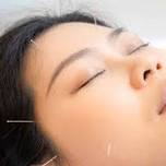 2-Day Cosmetic Acupuncture and Facial Rejuvenation Workshop