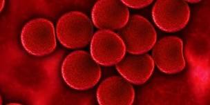 When good cells go bad: Immune-Mediated Hemolytic Anemia & Thrombocytopenia