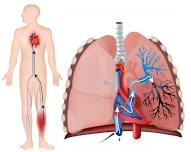 June Mini CE Event: Treatment Roadmap for Acute Venous Thromboembolism