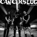 Cancerslug (25th Anniversary Home Show)