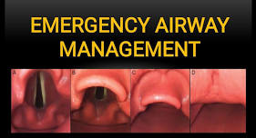 Advanced Emergency Airway Management Course