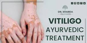 Providing Vitiligo Ayurvedic Treatment only at Dr. Sharda Ayurveda