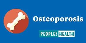 Understanding Osteoporosis (EVENT IS FULL)