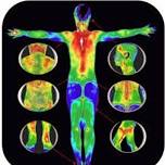 Thermography