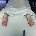 History & Intro to Cupping Therapy