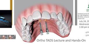 Orthodontic Temporary Anchorage Devices (TADS): Lecture and Hands-On Workshop